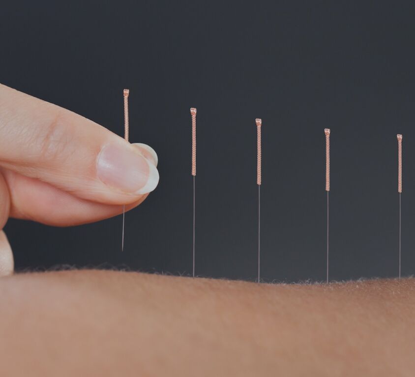 ACUPUNCTURE / TRADITIONAL CHINESE MEDICINE - Balance Complimentary Medicine