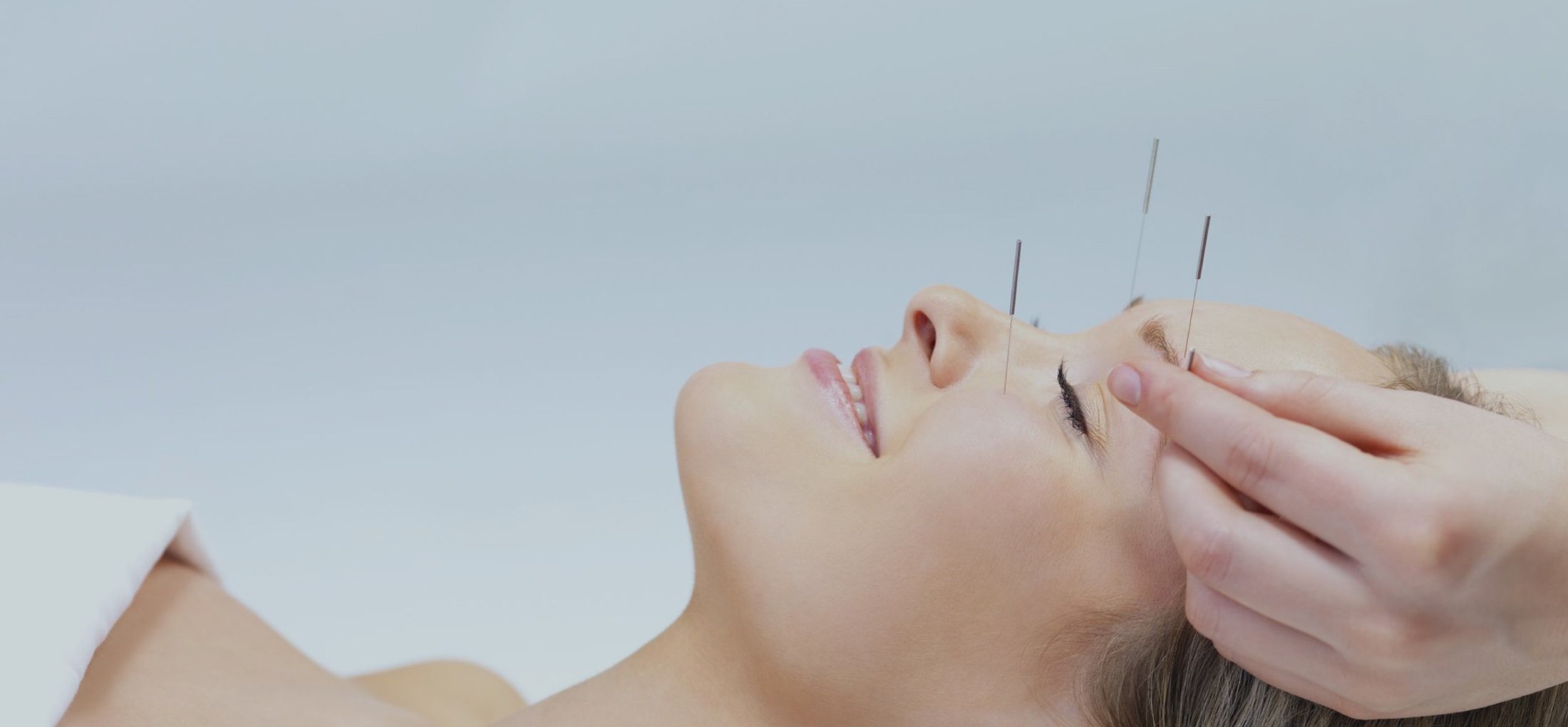 A woman getting acupuncture on her face