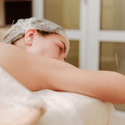 When Is the Best Time to Get Acupuncture When Trying to Conceive?