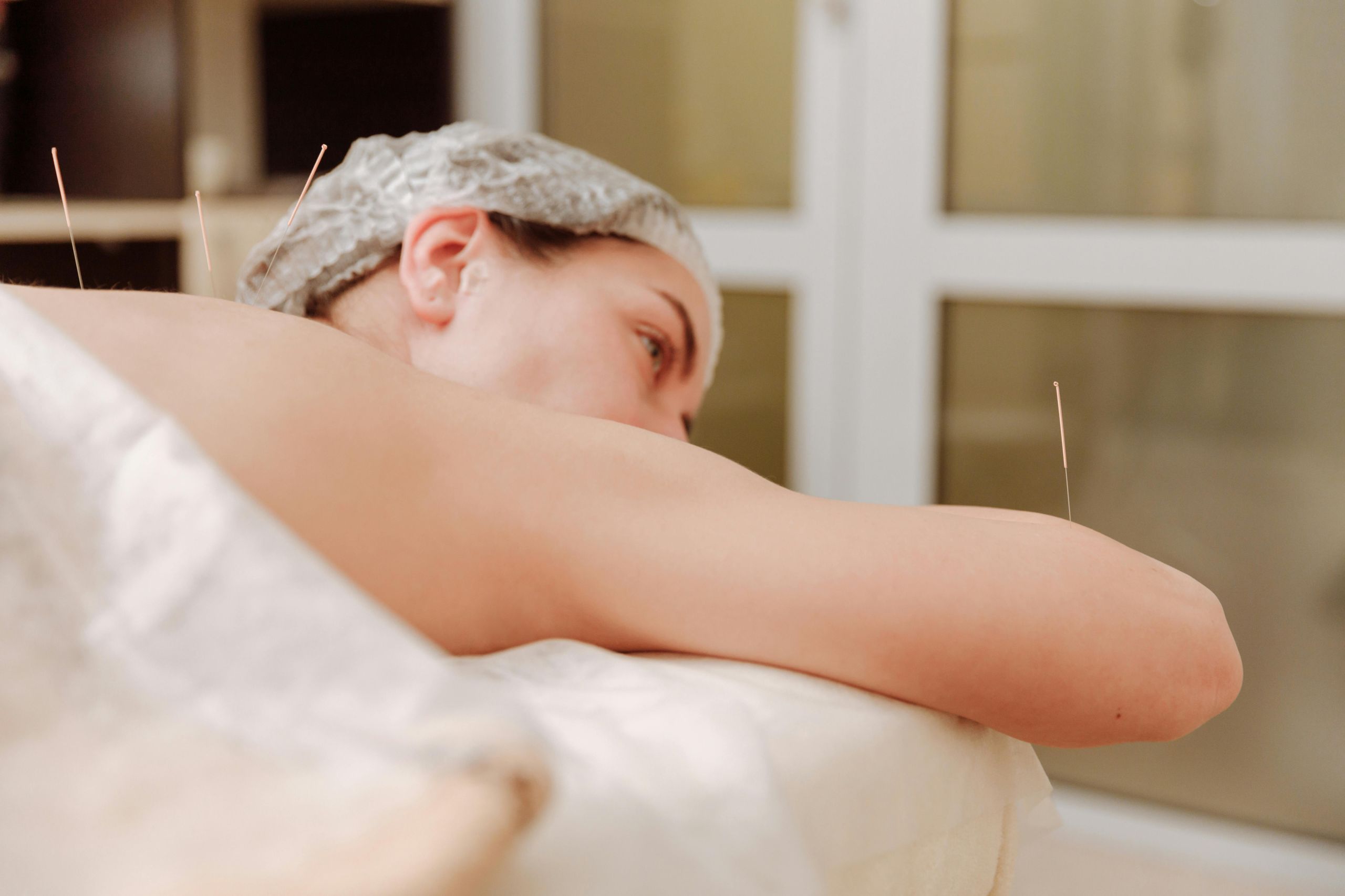 When Is the Best Time to Get Acupuncture When Trying to Conceive?